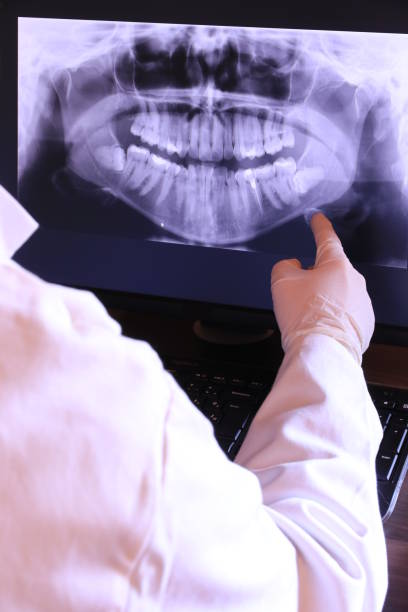 Best Emergency Broken Tooth Repair in Wildwood Crest, NJ